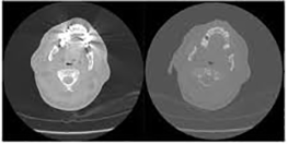 Dark endoscopic view
