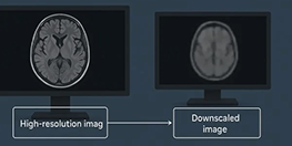 Endoscope image